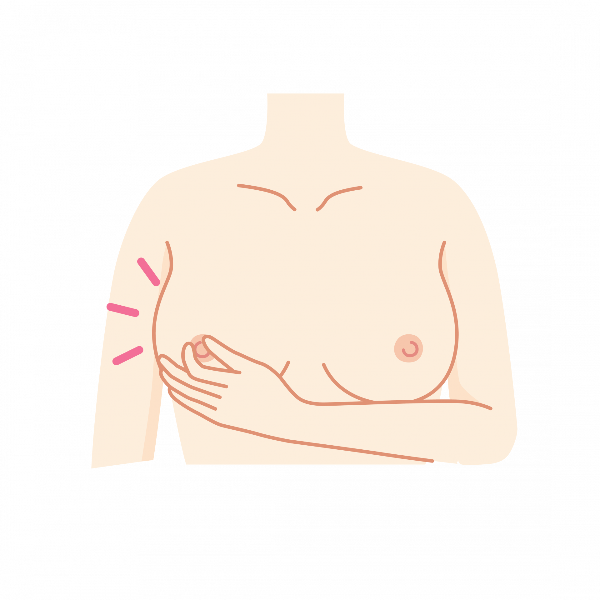 Tritt Flüssigkeit aus?
Drücke die Brüste leicht mit deinen Händen zusammen und achte darauf, ob aus deinen Brustwarzen Flüssigkeit austritt.