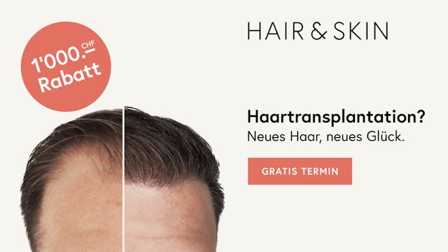 Profitiere jetzt für kurze Zeit von CHF 1'000 Rabatt auf deine Haartransplantation!