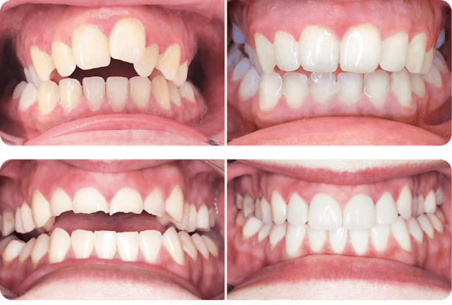 Les photos avant-après sont impressionnantes!