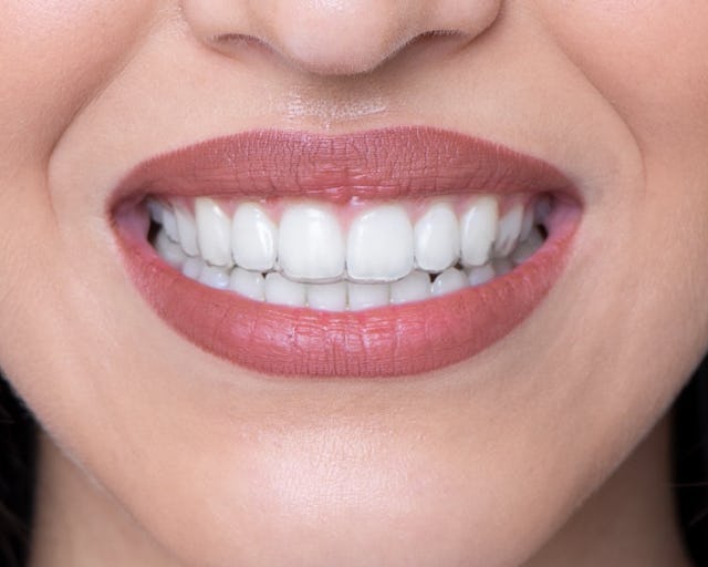 Die Schweizer bestsmile Aligner sind kaum sichtbar.