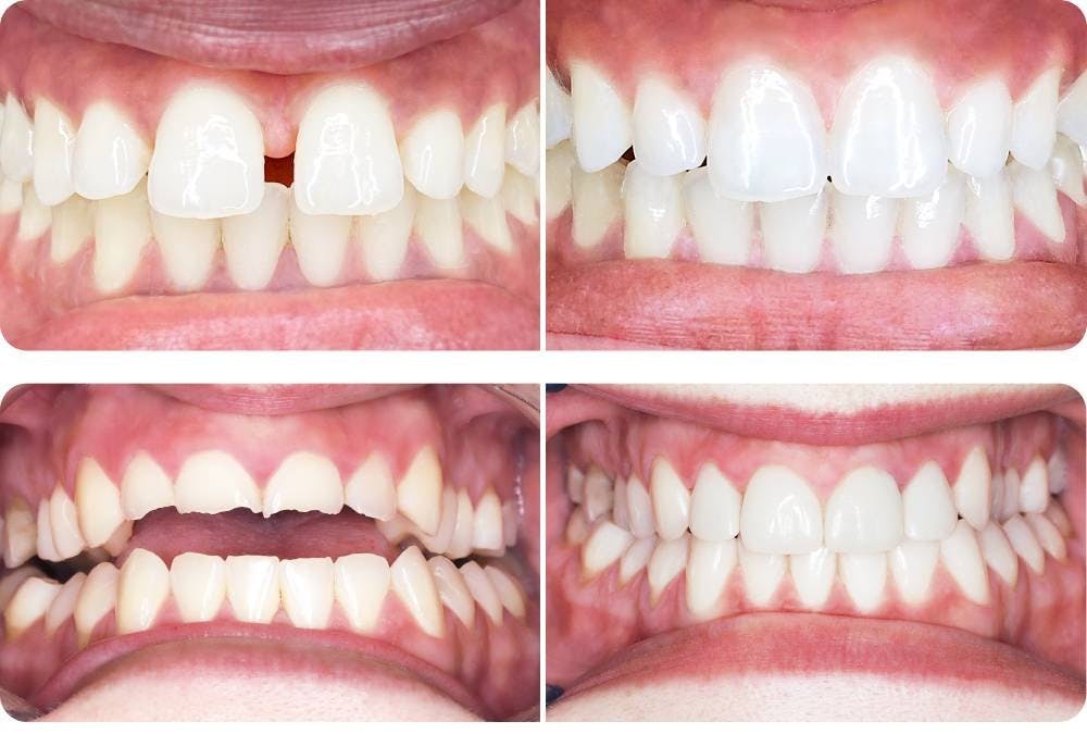 Beeindruckend: Der Vorher-Nachher-Vergleich zeigt die Ergebnisse.