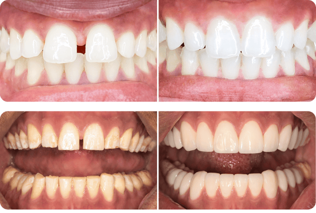 Les photos avant-après sont impressionnantes!