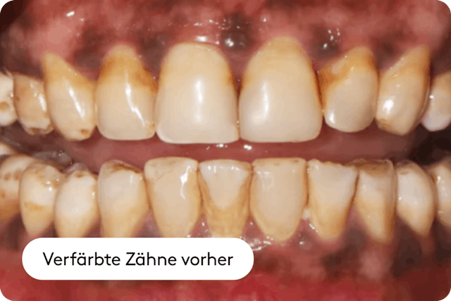 Verfärbung durch Lebensmittel