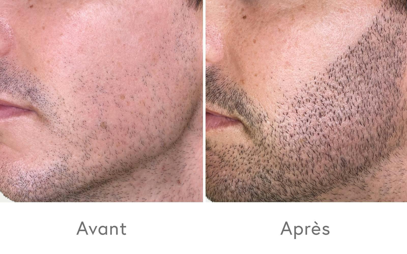 Des résultats très convaincants après une