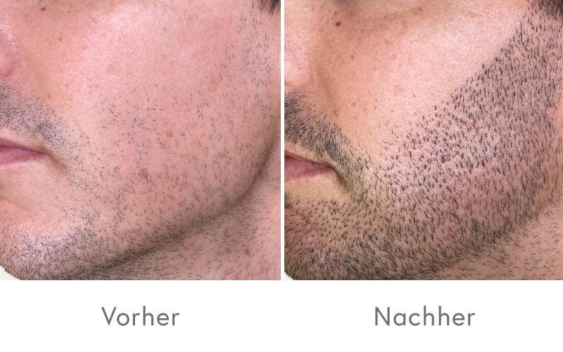 Überzeugende Ergebnisse nach einer