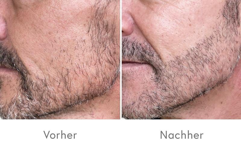 Überzeugende Ergebnisse nach einer