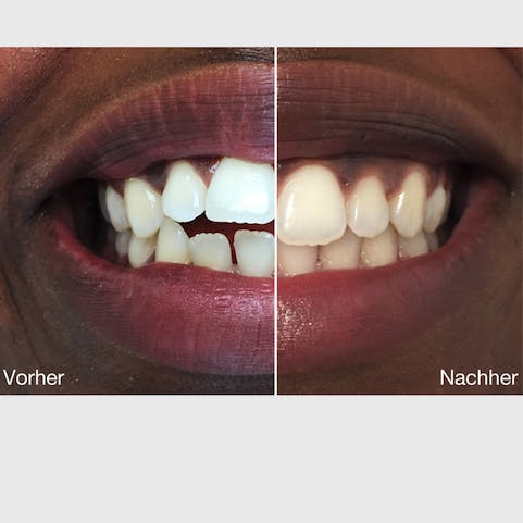 4. Beeindruckende Ergebnisse in wenigen Monaten