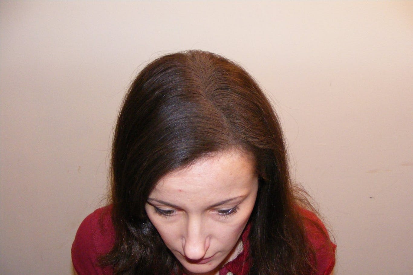 Nachher: Der Spray wirkt über Haarverdichtungspartikel.