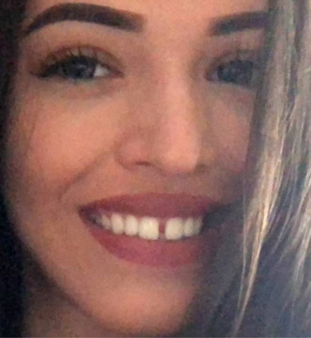 Melissas altes Lächeln mit Zahnlücke