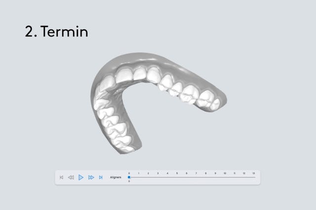 Besprechung deines Behandlungsplans anhand einer Vorher-Nachher 3D-Simulation.