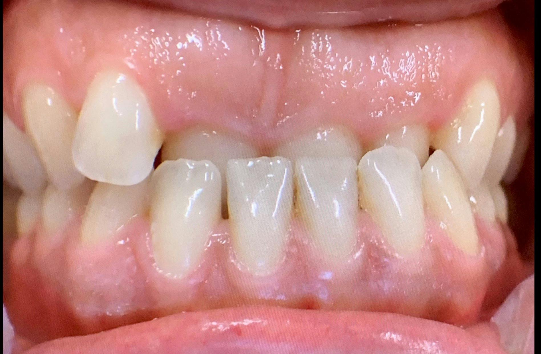 Vorher vs. Nachher (nächstes Bild)