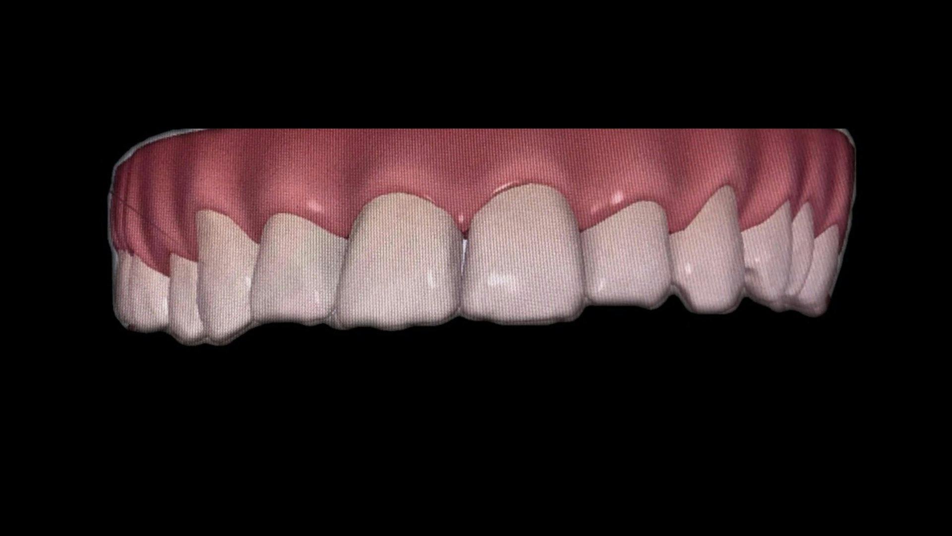 Nachher mit Korrektur.