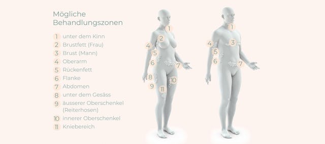 Unterschiede bei Frauen und Männern.