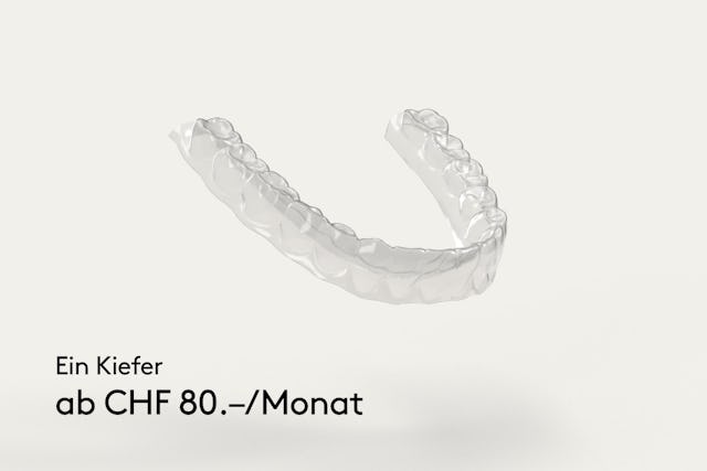 Monatliche Rate ab 80 Franken möglich. 1 Prozent Zins auf den Restbetrag.