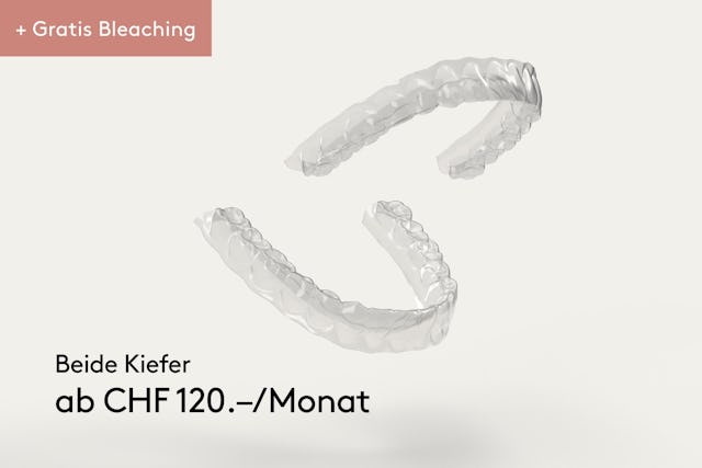 Monatliche Rate ab 120 Franken möglich. 1 Prozent Zins auf den Restbetrag.