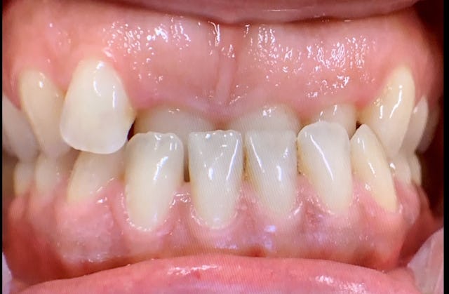 Vorher vs. Nachher (nächstes Bild)