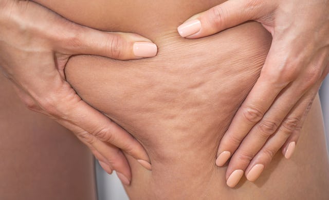 Cellulite ist ganz natürlich – aber für Viele nicht schön anzusehen. Zum Glück gibt es Mittel dagegen.