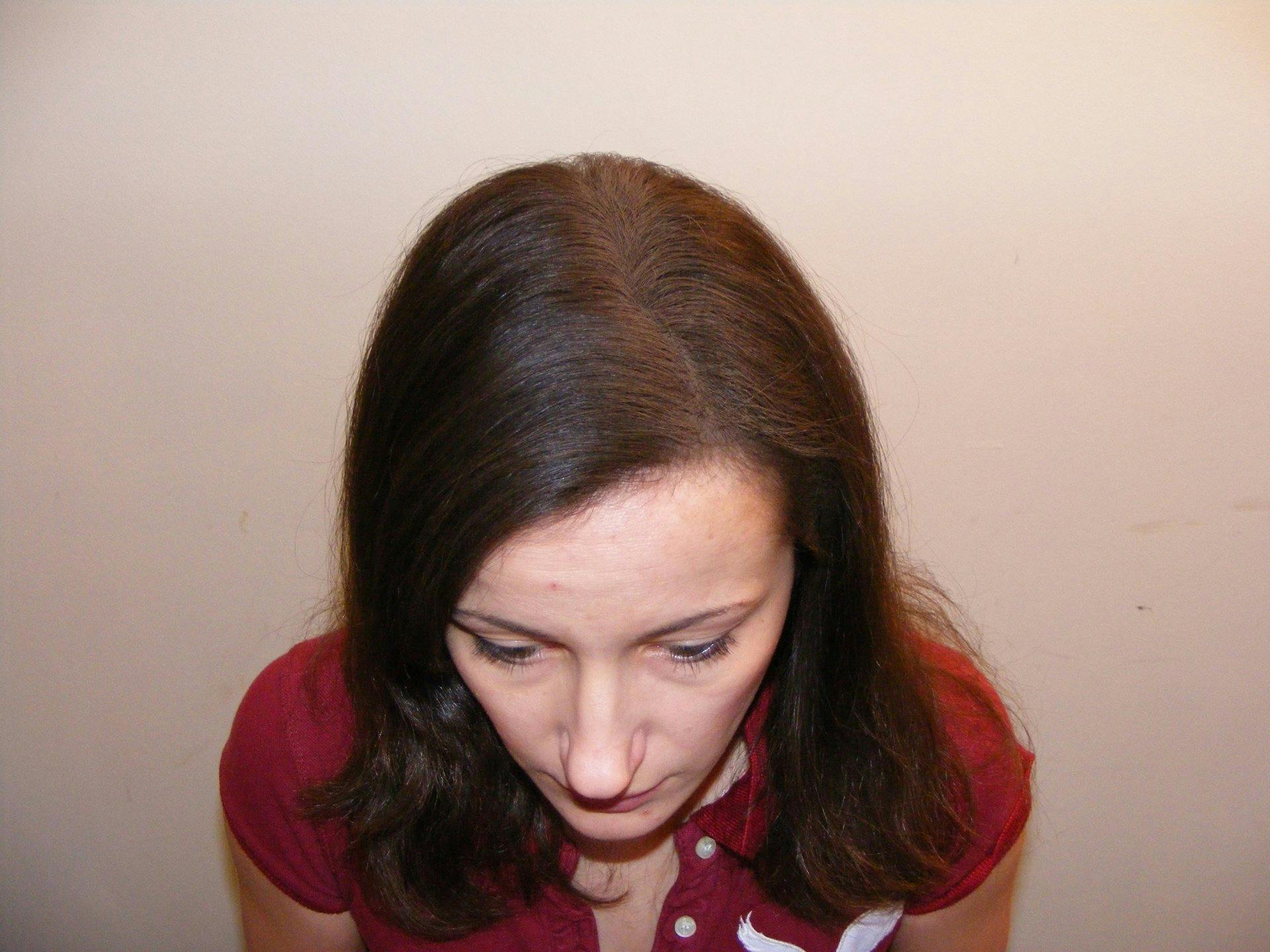 Nachher: Der Spray wirkt über Haarverdichtungspartikel.