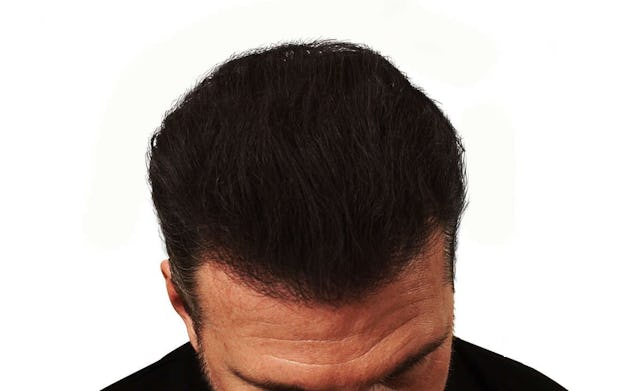 Nachher: Der Effekt des Sprays hält auch bei Schwitzen und Regen während des ganzen Tages.