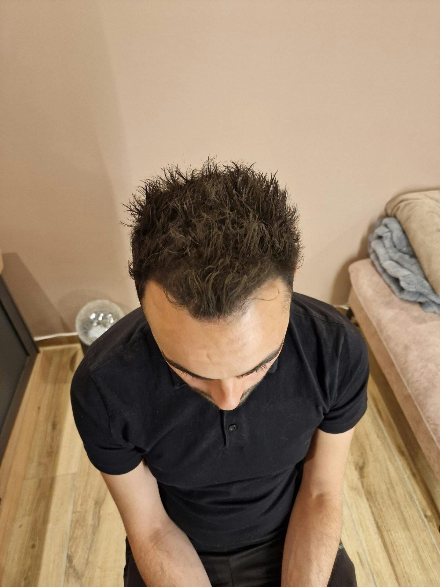 Nachher: Der Effekt des Sprays hält auch bei Schwitzen und Regen während des ganzen Tages.