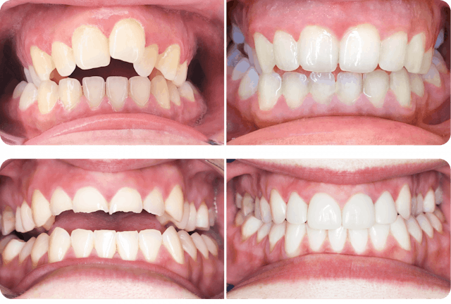 Beeindruckend: Der Vorher-Nachher-Vergleich zeigt die Ergebnisse.