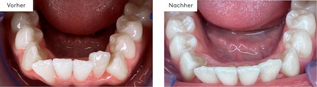 14 Schienen - 7 Monate