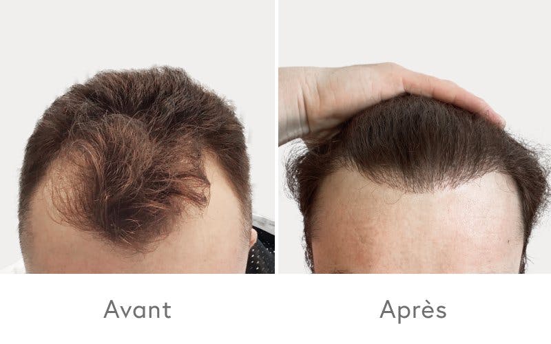 L'amélioration est visible.