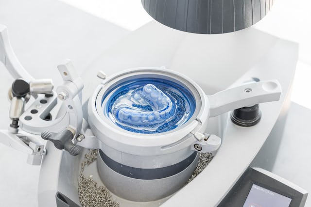 Un résultat en profondeur et de longue durée grâce aux gouttières de blanchiment sur-mesure