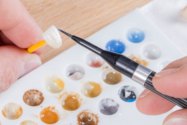 Des facettes dentaires qui s'adaptent parfaitement à la couleur de ton sourire.