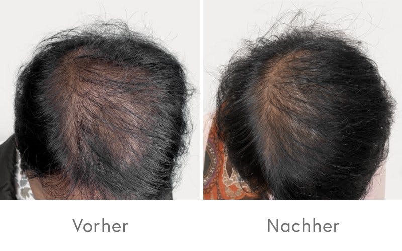 HAIR & SKIN machts möglich.