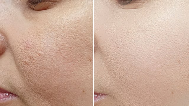 Der Vergleich: Vorher (links), nachher (rechts).