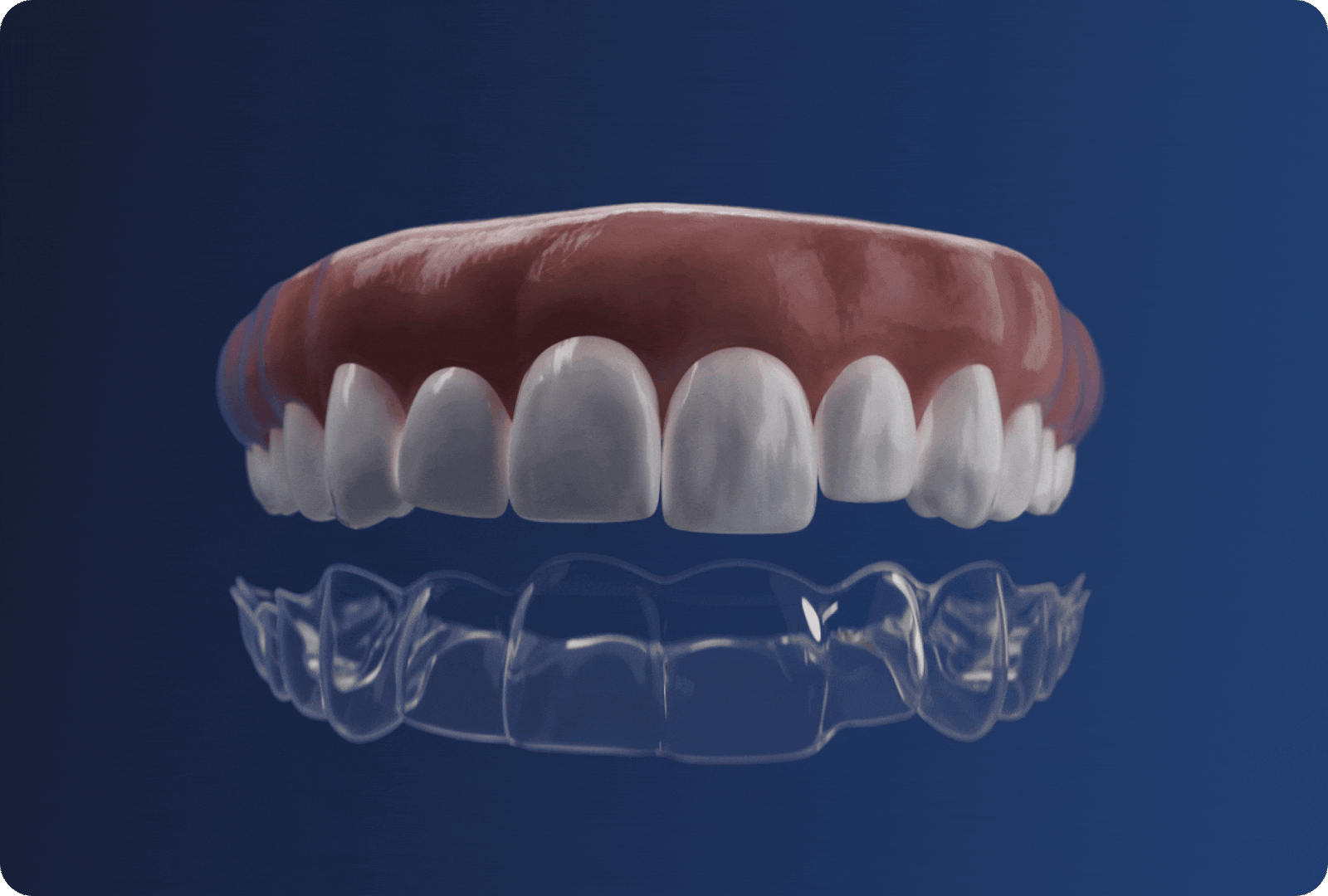 Il sonno di bellezza per i tuoi denti Tio