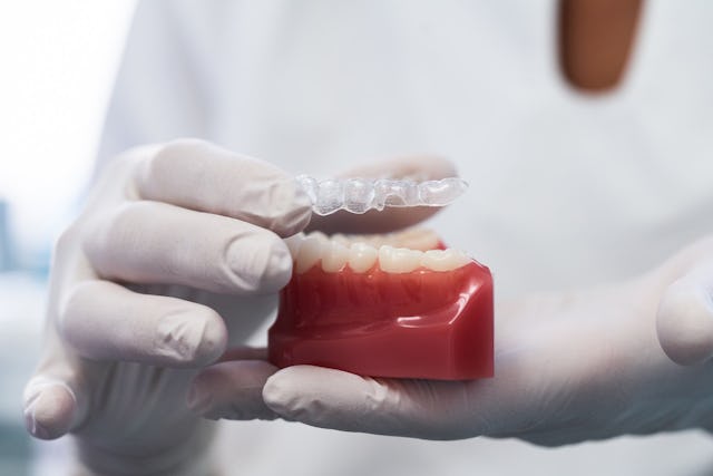 Ausrichtung der Zähne mit transparenten Schienen.