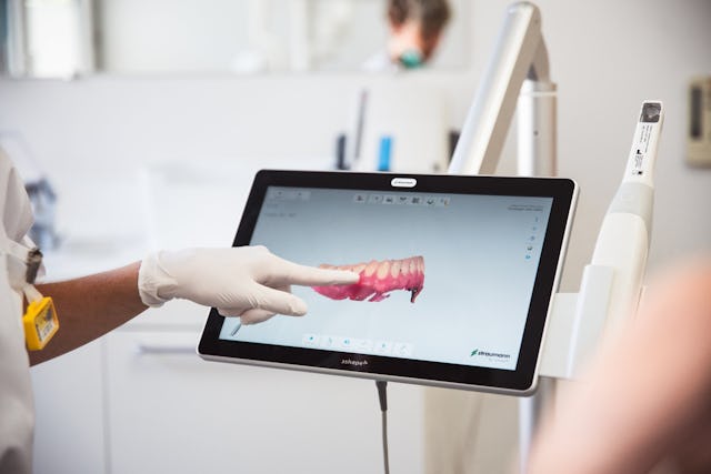 3D-Bildgebung - intraoraler Scanner mit dreidimensionaler Bildwiedergabe.