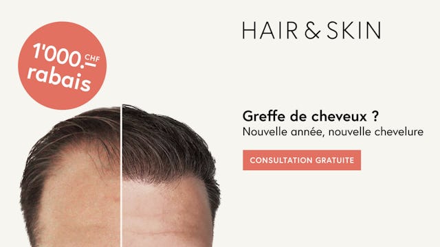 Profite de cette super réduction pendant une courte période! Profite de cette super réduction pendant une courte période!