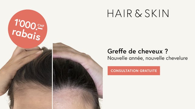 Profite maintenant du rabais de Nouvel An pour une courte durée!